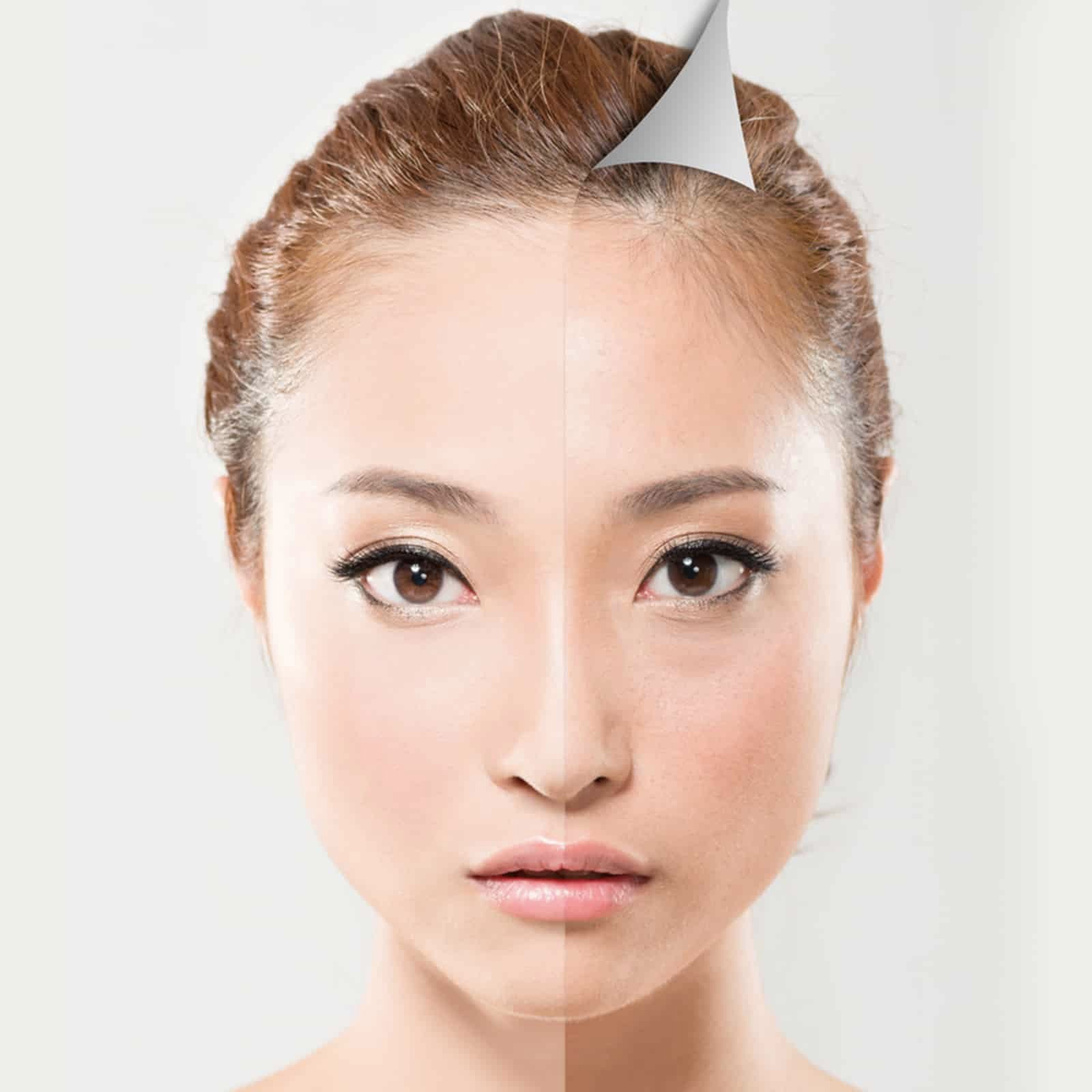 Featured facial rejuvenation treatment in KL, Malaysia