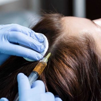 Hair Loss Treatment - True Clinic